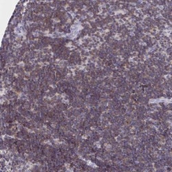 CXCL8/IL-8 Antibody, Novus Biologicals:Antibodies:Primary Antibodies