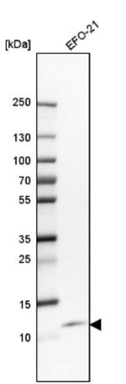 CXCL8/IL-8 Antibody, Novus Biologicals:Antibodies:Primary Antibodies