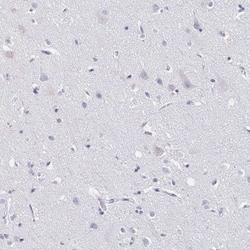 CXCR2/IL-8RB Rabbit anti-Human, Polyclonal, Novus Biologicals 0.1mL; Unlabeled:Antibodies,