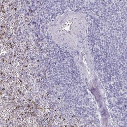 CXCR2/IL-8RB Rabbit anti-Human, Polyclonal, Novus Biologicals 0.1mL; Unlabeled:Antibodies,