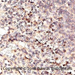 CXCR3 Antibody, Novus Biologicals 0.025mg; Unlabeled:Antibodies, Polyclonal
