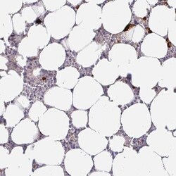 CXCR3 Antibody, Novus Biologicals 25 &mu;L, Unlabeled:Antibodies, Polyclonal