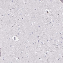 CXCR3 Antibody, Novus Biologicals 25 &mu;L, Unlabeled:Antibodies, Polyclonal
