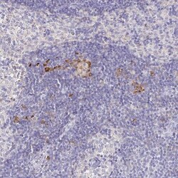 CXCR3 Antibody, Novus Biologicals 25 &mu;L, Unlabeled:Antibodies, Polyclonal
