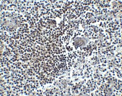 CXCR4 Antibody - BSA Free, Novus Biologicals 0.025mg:Antibodies, Polyclonal