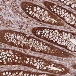 RADX Antibody, Novus Biologicals:Antibodies:Primary Antibodies