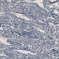 CT83 Antibody, Novus Biologicals:Antibodies:Primary Antibodies