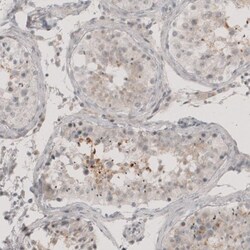 CT83 Antibody, Novus Biologicals:Antibodies:Primary Antibodies