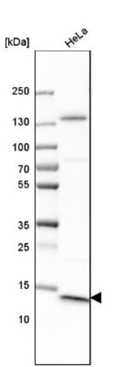 CT83 Antibody, Novus Biologicals:Antibodies:Primary Antibodies