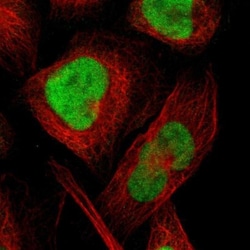CXorf67 Antibody, Novus Biologicals 25 &mu;L; Unlabeled:Antibodies, Polyclonal