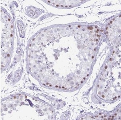 CXorf67 Antibody, Novus Biologicals 25 &mu;L | Buy Online | Novus Biologicals | Fisher Scientific