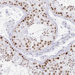 CXorf67 Antibody, Novus Biologicals 25 &mu;L; Unlabeled:Antibodies, Polyclonal