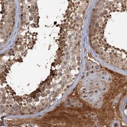 CYB5R2 Antibody, Novus Biologicals 0.1 mL | Buy Online | Novus Biologicals | Fisher Scientific