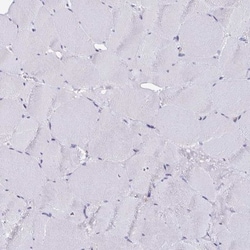 CYBB/NOX2 Antibody, Novus Biologicals 0.1mL; Unlabeled:Antibodies, Polyclonal