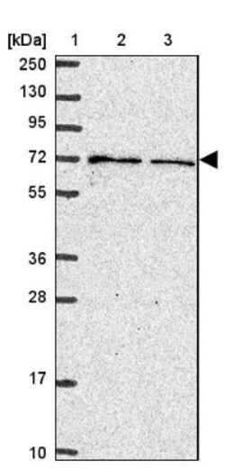 CYBB/NOX2 Antibody, Novus Biologicals 0.1mL; Unlabeled:Antibodies, Polyclonal