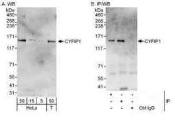 CYFIP1 Antibody, Novus Biologicals 100 &mu;L | Buy Online | Novus Biologicals | Fisher Scientific