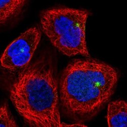 CYLD Antibody, Novus Biologicals:Antibodies:Primary Antibodies