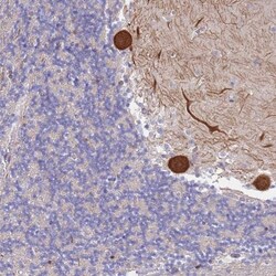 CYLD Antibody, Novus Biologicals:Antibodies:Primary Antibodies