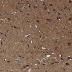 CYLN2 Antibody, Novus Biologicals 0.1mL; Unlabeled:Antibodies, Polyclonal