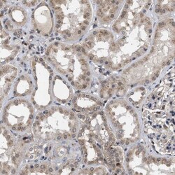 CYLN2 Antibody, Novus Biologicals 0.1mL; Unlabeled:Antibodies, Polyclonal