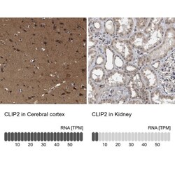 CYLN2 Antibody, Novus Biologicals 0.1mL; Unlabeled:Antibodies, Polyclonal