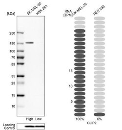 CYLN2 Antibody, Novus Biologicals 0.1mL; Unlabeled:Antibodies, Polyclonal