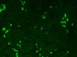 CYP11A1 Antibody, Novus Biologicals:Antibodies:Primary Antibodies