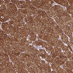 CYP21A2 Antibody, Novus Biologicals 0.1mL; Unlabeled:Antibodies, Polyclonal