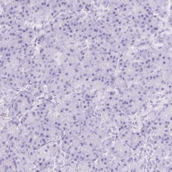 CYP21A2 Antibody, Novus Biologicals 0.1mL; Unlabeled:Antibodies, Polyclonal