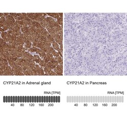 CYP21A2 Antibody, Novus Biologicals 0.1mL; Unlabeled:Antibodies, Polyclonal