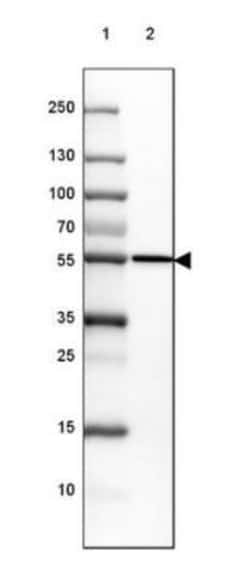 CYP21A2 Antibody, Novus Biologicals 0.1mL; Unlabeled:Antibodies, Polyclonal