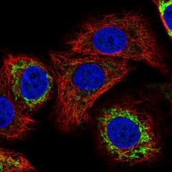 CYP24A1 Antibody, Novus Biologicals 0.1mL; Unlabeled:Antibodies, Polyclonal