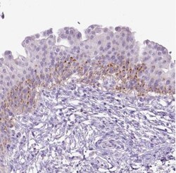CYP24A1 Antibody, Novus Biologicals 0.1mL; Unlabeled:Antibodies, Polyclonal