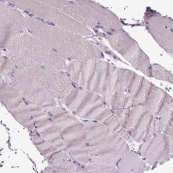 CYP24A1 Antibody, Novus Biologicals 0.1mL; Unlabeled:Antibodies, Polyclonal