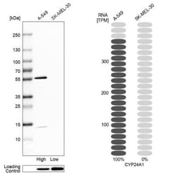 CYP24A1 Antibody, Novus Biologicals 0.1mL; Unlabeled:Antibodies, Polyclonal