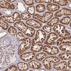 CYP27A1 Antibody, Novus Biologicals 0.1mL; Unlabeled:Antibodies, Polyclonal