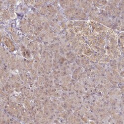 CYP27A1 Antibody, Novus Biologicals 0.1mL; Unlabeled:Antibodies, Polyclonal