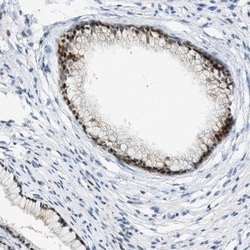 CYP4X1 Antibody, Novus Biologicals 0.1mL; Unlabeled:Antibodies, Polyclonal
