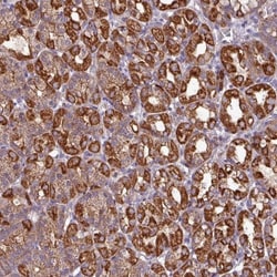 CaM Kinase I Antibody, Novus Biologicals 0.1mL; Unlabeled:Antibodies, Polyclonal