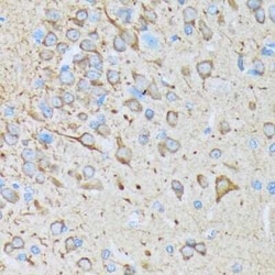 CaM Kinase II Rabbit anti-Human, Mouse, Rat, Clone: 9P2E2, Novus Biologicals:Antibodies:Primary