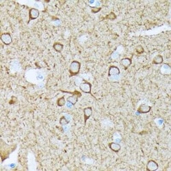 CaM Kinase II Rabbit anti-Human, Mouse, Rat, Clone: 9P2E2, Novus Biologicals:Antibodies:Primary