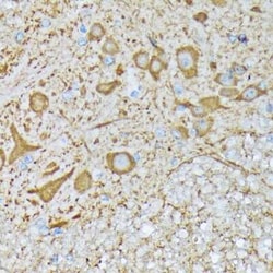 CaM Kinase II Rabbit anti-Human, Mouse, Rat, Clone: 9P2E2, Novus Biologicals:Antibodies:Primary