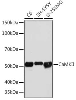 CaM Kinase II Rabbit anti-Human, Mouse, Rat, Clone: 9P2E2, Novus Biologicals:Antibodies:Primary