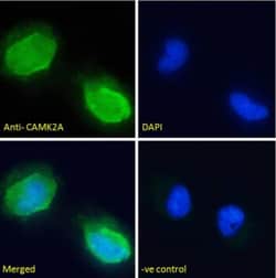 CaM Kinase II alpha Antibody, Novus Biologicals 0.1mg; Unlabeled:Antibodies,