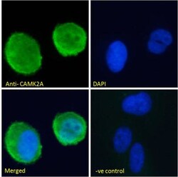 CaM Kinase II alpha Antibody, Novus Biologicals 0.1mg; Unlabeled:Antibodies,