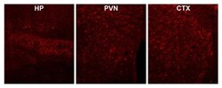 CaM Kinase II alpha Antibody, Novus Biologicals 0.1mg; Unlabeled:Antibodies,