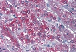 CaM Kinase II alpha Antibody, Novus Biologicals 0.1mg; Unlabeled:Antibodies,