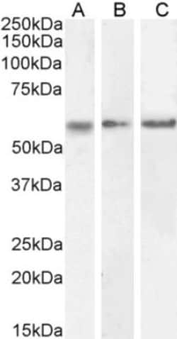 CaM Kinase II alpha Antibody, Novus Biologicals 0.1mg; Unlabeled:Antibodies,