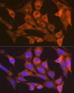 CaM Kinase II delta Rabbit anti-Human, Mouse, Rat, Clone: 10M1P2, Novus Biologicals 100 &mu;g | Buy Online | Novus Biologicals | Fisher Scientific