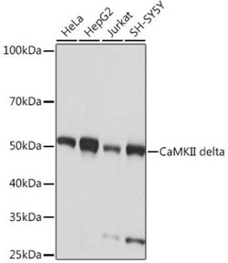 CaM Kinase II delta Rabbit anti-Human, Mouse, Rat, Clone: 10M1P2, Novus Biologicals 100 &mu;g | Buy Online | Novus Biologicals | Fisher Scientific
